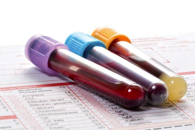 Examesbioquimicos